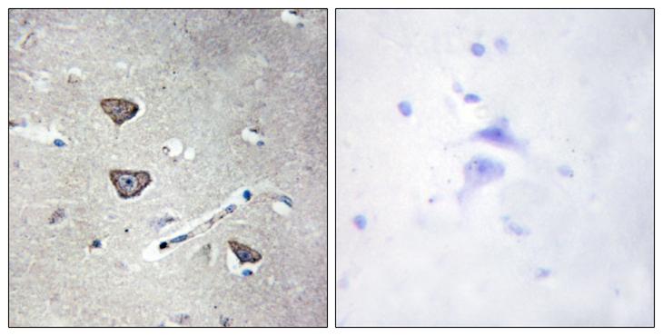 HTR2C / 5-HT2C Receptor Antibody - Peptide - + Immunohistochemistry analysis of paraffin-embedded human brain tissue, using 5-HT-2C antibody.