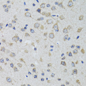 HTR3A / 5-HT3A Receptor Antibody - Immunohistochemistry of paraffin-embedded rat brain tissue.