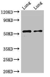 HTR3A / 5-HT3A Receptor Antibody - Positive WB detected in:Rat lung tissue,Mouse lung tissue;All lanes:HTR3A antibody at 2.5?g/ml;Secondary;Goat polyclonal to rabbit IgG at 1/50000 dilution;Predicted band size: 56,59,54,60 KDa;Observed band size: 56 KDa;