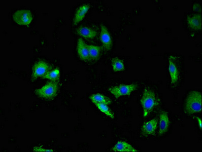 HTR3A / 5-HT3A Receptor Antibody - Immunofluorescent analysis of HepG2 cells using HTR3A Antibody at dilution of 1:100 and Alexa Fluor 488-congugated AffiniPure Goat Anti-Rabbit IgG(H+L)