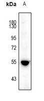 HTR3A / 5-HT3A Receptor Antibody - Western blot analysis of 5-HT3A expression in HT29 (A) whole cell lysates.