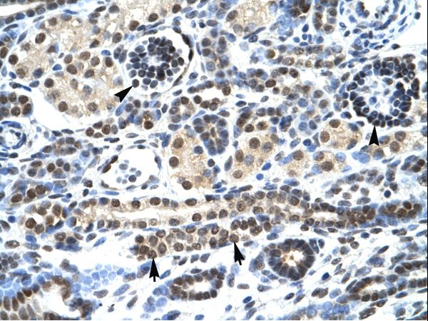 HTR3A / 5-HT3A Receptor Antibody - Human Kidney.  This image was taken for the unconjugated form of this product. Other forms have not been tested.