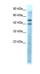 HTR3A / 5-HT3A Receptor Antibody - HTR3A / 5-HT3A antibody Western blot of Jurkat lysate. This image was taken for the unconjugated form of this product. Other forms have not been tested.