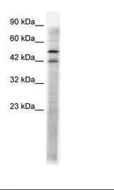 HTR3A / 5-HT3A Receptor Antibody - Jurkat Cell Lysate.  This image was taken for the unconjugated form of this product. Other forms have not been tested.