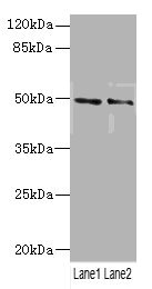 HTR3B / 5-HT3B Receptor Antibody - Western blot All Lanes: HTR3Bantibody at 3.29ug/ml Lane 1: Mouse lung tissue Lane 2: 293T whole cell lysate Secondary Goat polyclonal to rabbit IgG at 1/10000 dilution Predicted band size: 51,50 kDa Observed band size: 50 kDa