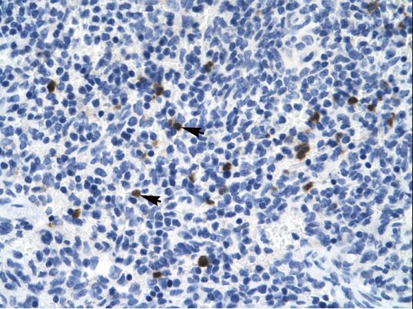 HTR3B / 5-HT3B Receptor Antibody - Human Spleen: Formalin-Fixed Paraffin-Embedded (FFPE).  This image was taken for the unconjugated form of this product. Other forms have not been tested.