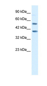 HTR3B / 5-HT3B Receptor Antibody - HTR3B / 5-HT3B antibody Western blot of Jurkat lysate. This image was taken for the unconjugated form of this product. Other forms have not been tested.