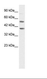 HTR3B / 5-HT3B Receptor Antibody - Jurkat Cell Lysate.  This image was taken for the unconjugated form of this product. Other forms have not been tested.
