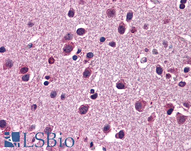 HTR3C / 5-HT3C Receptor Antibody - Anti-HTR3C / 5-HT3C antibody IHC of human brain, cortex. Immunohistochemistry of formalin-fixed, paraffin-embedded tissue after heat-induced antigen retrieval. Antibody concentration 5 ug/ml.  This image was taken for the unconjugated form of this product. Other forms have not been tested.