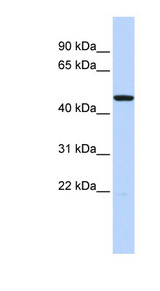 HTR3C / 5-HT3C Receptor Antibody - HTR3C / 5-HT3C antibody Western blot of Fetal Brain lysate. This image was taken for the unconjugated form of this product. Other forms have not been tested.