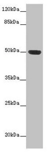 HTR3D / 5HT3D Receptor Antibody - Western blot All lanes: HTR3D antibody at 2µg/ml + Hela whole cell lysate Secondary Goat polyclonal to rabbit IgG at 1/10000 dilution Predicted band size: 51, 31, 26, 46 kDa Observed band size: 51 kDa