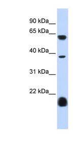 HTR3E / 5-HT3E Receptor Antibody - HTR3E / 5-HT3E antibody Western blot of Fetal Heart lysate. This image was taken for the unconjugated form of this product. Other forms have not been tested.