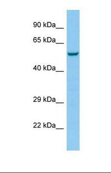 HTR3E / 5-HT3E Receptor Antibody - Western blot of Human NCI-H226. HTR3E antibody dilution 1.0 ug/ml.  This image was taken for the unconjugated form of this product. Other forms have not been tested.