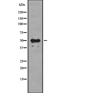 HTR3E / 5-HT3E Receptor Antibody - Western blot analysis of HTR3E expression in HEK293 cells. The lane on the left is treated with the antigen-specific peptide.