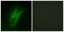 HTR4 / 5-HT4 Receptor Antibody - Immunofluorescence analysis of HeLa cells, using 5-HT-4 Antibody. The picture on the right is blocked with the synthesized peptide.