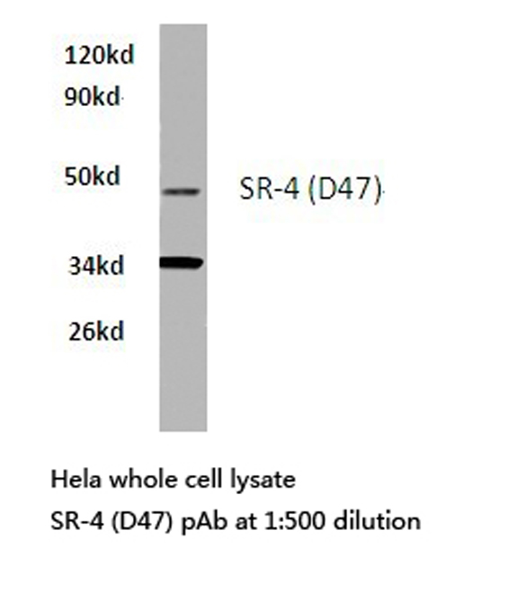 HTR4 / 5-HT4 Receptor Antibody - Western blot of SR-4 (D47) pAb in extracts from HeLa cells.