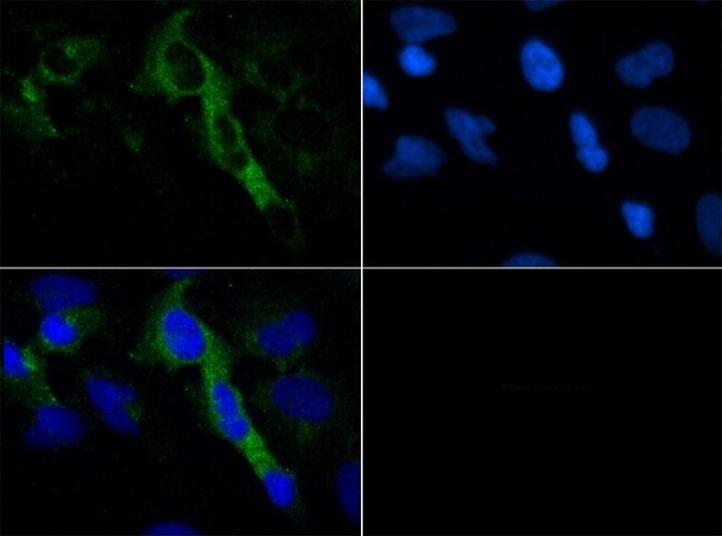 HTR4 / 5-HT4 Receptor Antibody - Immunocytochemistry/Immunofluorescence: 5HT4 Receptor Antibody - ICC staining of 5HT4 receptor in HeLa cells with FITC (green). Nuclei were counterstained with DAPI (blue).  This image was taken for the unconjugated form of this product. Other forms have not been tested.