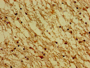 HTR4 / 5-HT4 Receptor Antibody - Immunohistochemistry image of paraffin-embedded human brain tissue at a dilution of 1:100