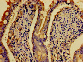 HTR4 / 5-HT4 Receptor Antibody - Immunohistochemistry image of paraffin-embedded human small intestine tissue at a dilution of 1:100