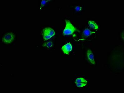 HTR4 / 5-HT4 Receptor Antibody - Immunofluorescence staining of MCF-7 cells with HTR4 Antibody at 1:100, counter-stained with DAPI. The cells were fixed in 4% formaldehyde, permeabilized using 0.2% Triton X-100 and blocked in 10% normal Goat Serum. The cells were then incubated with the antibody overnight at 4°C. The secondary antibody was Alexa Fluor 488-congugated AffiniPure Goat Anti-Rabbit IgG(H+L).