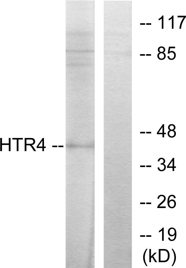 HTR4 / 5-HT4 Receptor Antibody - Western blot analysis of extracts from 293 cells, treated with insulin (0.01U/ml, 15mins), using 5-HT-4 antibody.