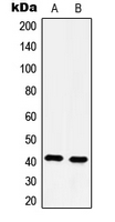 HTR4 / 5-HT4 Receptor Antibody - Western blot analysis of 5-HT4 expression in HeLa (A); Jurkat (B) whole cell lysates.