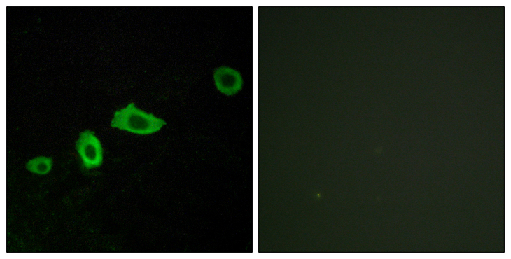 HTR5A / 5-HT5A Receptor Antibody - Immunofluorescence analysis of LOVO cells, using HTR5A Antibody. The picture on the right is blocked with the synthesized peptide.