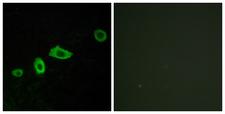 HTR5A / 5-HT5A Receptor Antibody - Immunofluorescence analysis of LOVO cells, using HTR5A Antibody. The picture on the right is blocked with the synthesized peptide.