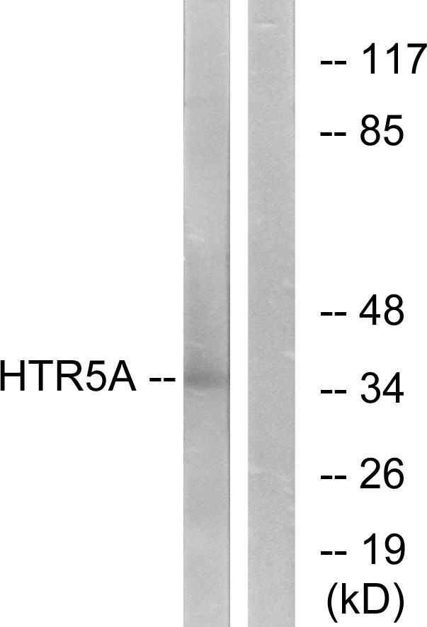 HTR5A / 5-HT5A Receptor Antibody - Western blot analysis of lysates from Jurkat cells, using HTR5A Antibody. The lane on the right is blocked with the synthesized peptide.