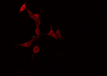 HTR5A / 5-HT5A Receptor Antibody - Staining HeLa cells by IF/ICC. The samples were fixed with PFA and permeabilized in 0.1% Triton X-100, then blocked in 10% serum for 45 min at 25°C. The primary antibody was diluted at 1:200 and incubated with the sample for 1 hour at 37°C. An Alexa Fluor 594 conjugated goat anti-rabbit IgG (H+L) antibody, diluted at 1/600, was used as secondary antibody.