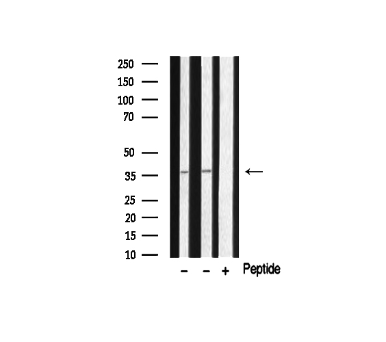 HTR5A / 5-HT5A Receptor Antibody - Western blot analysis of extracts of various tissue sample using 5-HT-5A antibody.