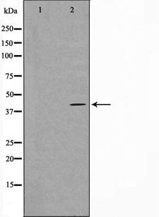 HTR5A / 5-HT5A Receptor Antibody - Western blot analysis on HeLa cell lysates using 5-HT-5A antibody. The lane on the left is treated with the antigen-specific peptide.