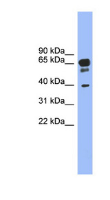HTR5A / 5-HT5A Receptor Antibody - HTR5A / 5-HT35A antibody Western blot of Fetal Stomach lysate. This image was taken for the unconjugated form of this product. Other forms have not been tested.