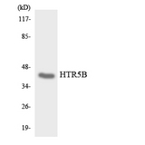 Htr5b Antibody - Western blot analysis of the lysates from HepG2 cells using HTR5B antibody.