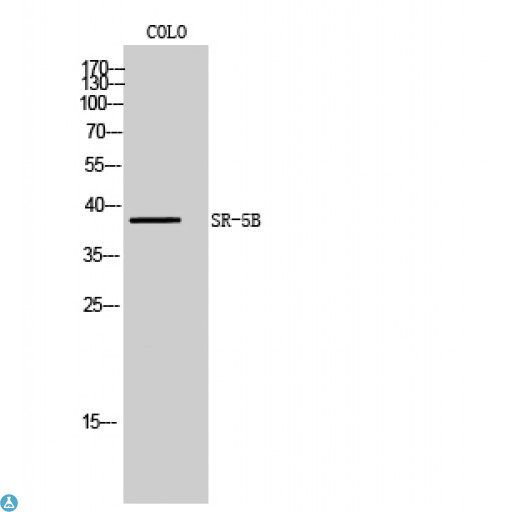 Htr5b Antibody - Western Blot (WB) analysis of COLO205 cells using SR-5B polyclonal antibody.