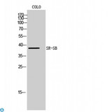 Htr5b Antibody - Western Blot (WB) analysis of COLO205 cells using SR-5B polyclonal antibody.