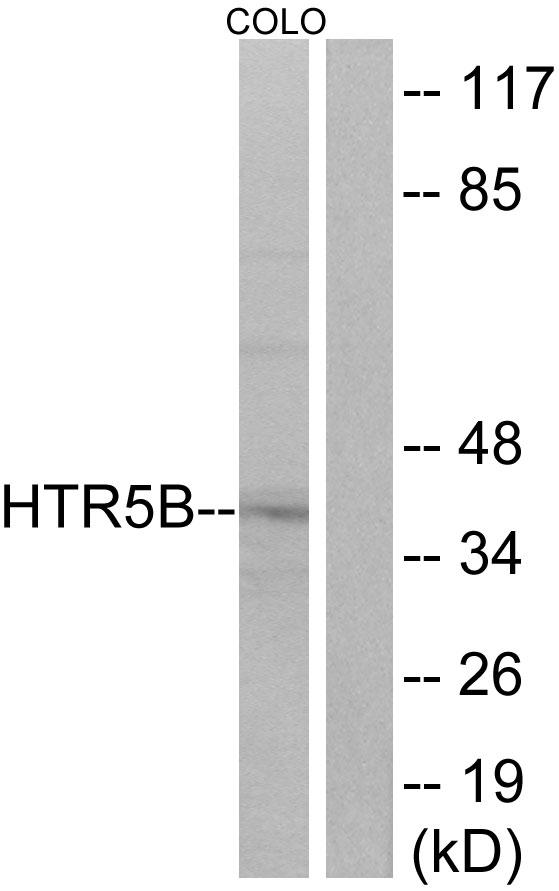 Htr5b Antibody - Western blot analysis of extracts from COLO cells, using HTR5B antibody.