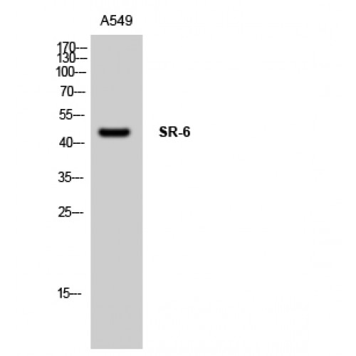 HTR6 / 5-HT6 Receptor Antibody - Western blot of SR-6 antibody