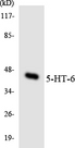 HTR6 / 5-HT6 Receptor Antibody - Western blot analysis of the lysates from COLO205 cells using 5-HT-6 antibody.
