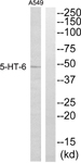 HTR6 / 5-HT6 Receptor Antibody - Western blot analysis of lysates from A549 cells, using 5-HT-6 Antibody. The lane on the right is blocked with the synthesized peptide.