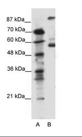 HTR7 / 5HT7 Receptor Antibody - A: Marker, B: Jurkat Cell Lysate.  This image was taken for the unconjugated form of this product. Other forms have not been tested.