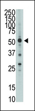 HTRA1 Antibody - The anti-HtrA1 N-term antibody is used in Western blot to detect HtrA1in mouse brain tissue lysate.