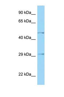 HTRA1 Antibody - HTRA1 antibody Western blot of Fetal Kidney lysate. Antibody concentration 1 ug/ml.  This image was taken for the unconjugated form of this product. Other forms have not been tested.