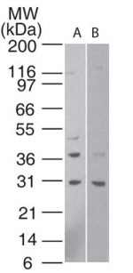 HTRA1 Antibody - Western blot analysis of HtrA1 in human A) HeLa cell lysate (1 minute exposure) and B) human 293 cell lysate (15 minute exposure) using antibody at 1:500.