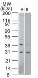 HTRA1 Antibody - Western blot analysis of HtrA1 in human A) HeLa cell lysate (1 minute exposure) and B) human 293 cell lysate (15 minute exposure) using antibody at 1:500.