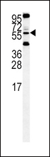 HTRA1 Antibody - HtrA1-K396 western blot of HeLa cell line lysates (35 ug/lane). The HtrA1 antibody detected the HtrA1 protein (arrow).