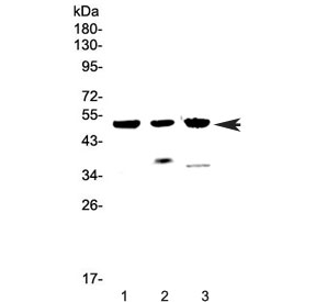 HTRA1 Antibody - Western blot testing of 1) human MCF7, 2) rat heart and 3) mouse heart lysate with HTRA1 antibody at 0.5ug/ml. Predicted molecular weight ~51 kDa.