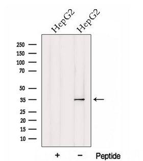 HTRA1 Antibody - Western blot analysis of extracts of HepG2 cells using HTRA1 antibody. The lane on the left was treated with blocking peptide.