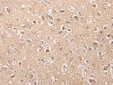 HTRA1 Antibody - Immunohistochemistry of paraffin-embedded Human brain tissue  using HTRA1  Polyclonal Antibody at dilution of 1:55(×200)