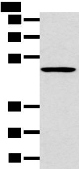 HTRA1 Antibody - Western blot analysis of 231 cell  using HTRA1  Polyclonal Antibody at dilution of 1:500